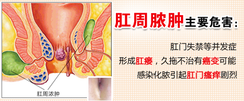 肛周脓肿的成因有哪些