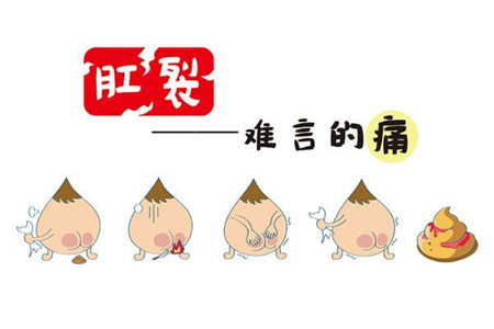 肛裂什么程度算严重